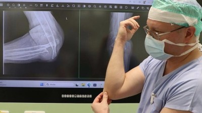 Unik&aacute;tn&iacute; v&yacute;kon v Chomutově: L&eacute;kaři nahradili pacientovi &bdquo;rozpadl&yacute;&ldquo; loket, se kter&yacute;m d&aacute;l nosil k&yacute;ble s vodou