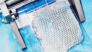 Mešovač díky nařezání kožního štěpu dokáže jeho původní plochu násobně zvětšit. Foto: Nemocnice Kadaň