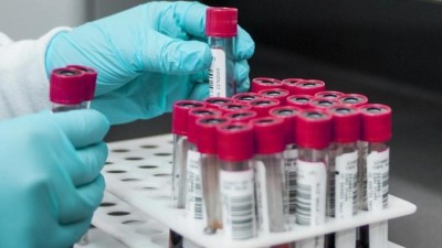 V Teplic&iacute;ch se v &uacute;ter&yacute; můžete nechat bezplatně a anonymně otestovat na HIV a dal&scaron;&iacute; nemoci